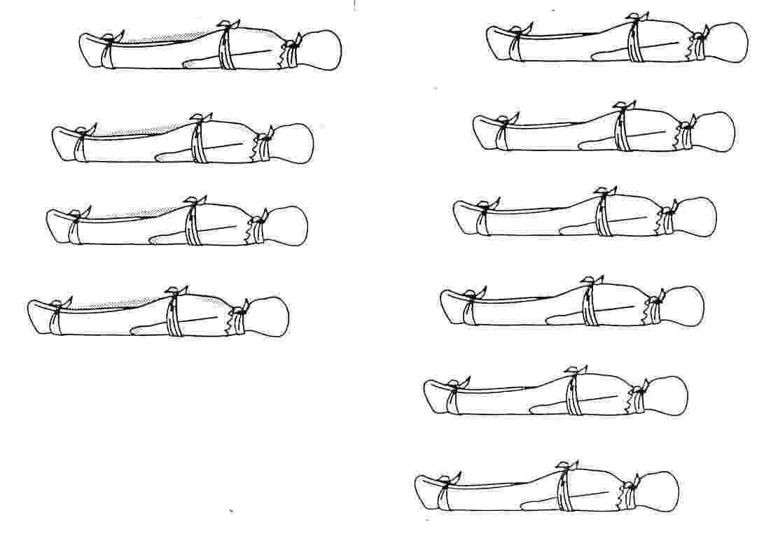 Nalgumas zonas de frica Oriental 
30 at 40 % das mortes so de SIDA